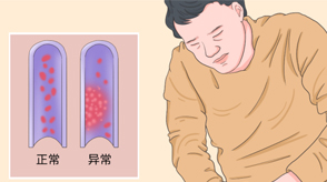 VTE的危害您了解嗎？