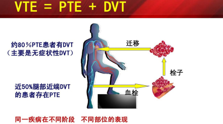 什么是臨床上一致公認的VTE防治基礎(chǔ)？