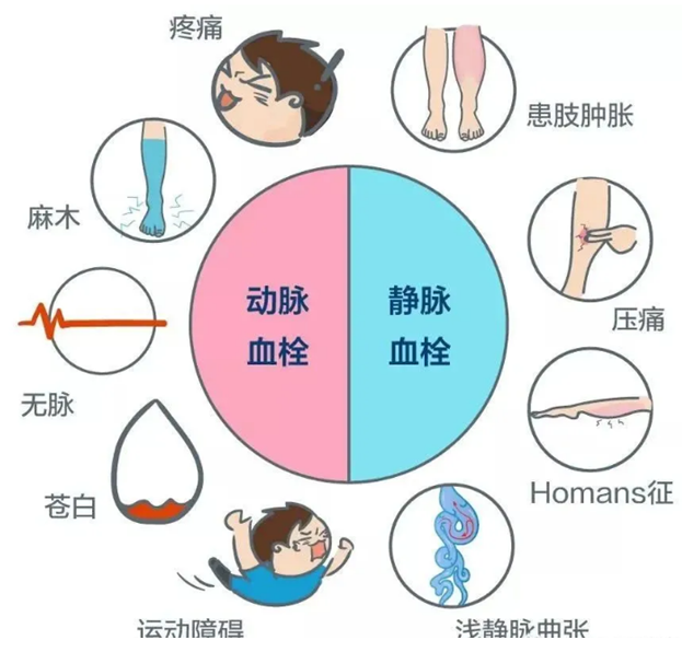 2022世界血栓日：就醫(yī)有新路，血栓找介入