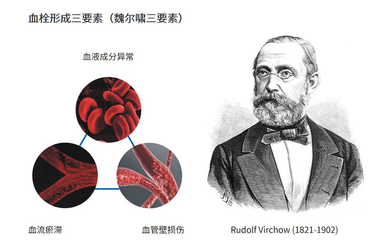 世界血栓日 | 拴不住，動(dòng)起來(lái)