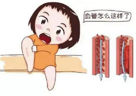 腫瘤不容忽視的第二號殺手—VTE，該如何防治？