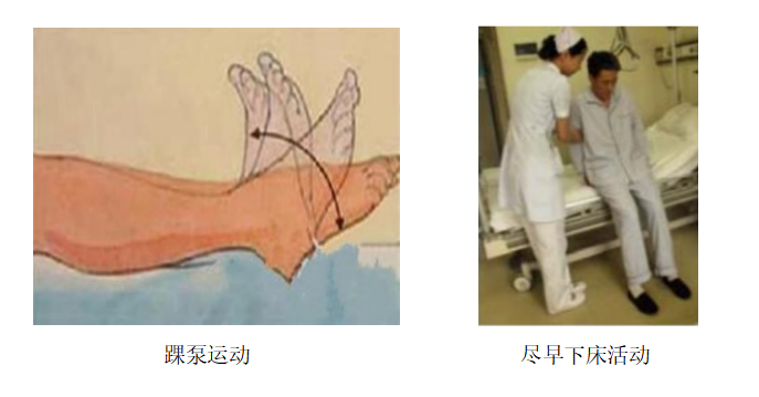 圍術(shù)期患者VTE的預(yù)防，只知道抗凝可不行