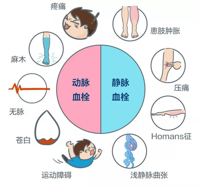 深靜脈血栓能致命，防治“大法”要了解！